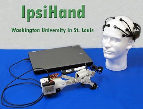 EEG-assisted Hand Control | Hackaday