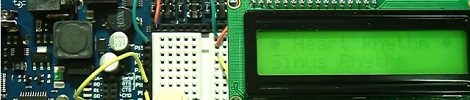 05 | January | 2012 | Hackaday