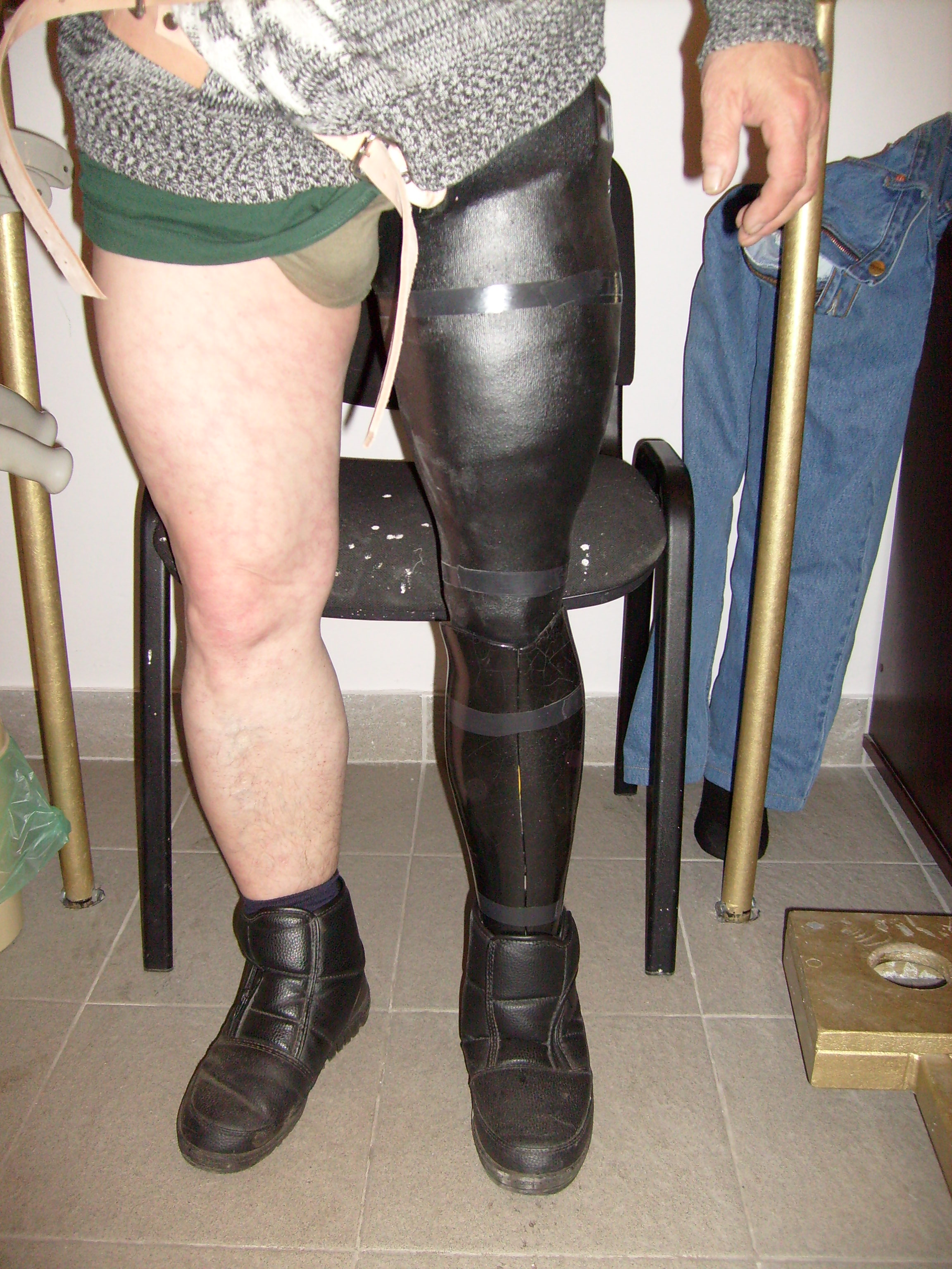 Building A Prosthetic Leg From Scratch | Hackaday