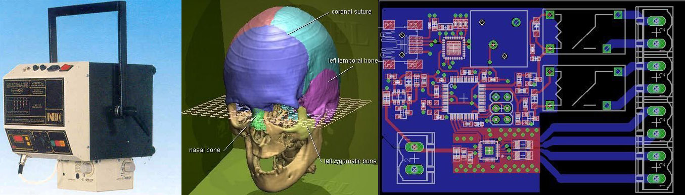 Hackaday Prize Entry A 100 Ct Scanner Hackaday