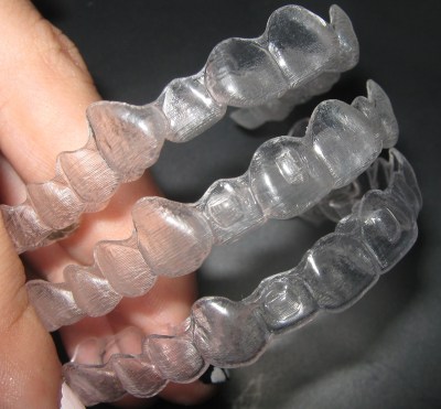 invisalign-top-trays