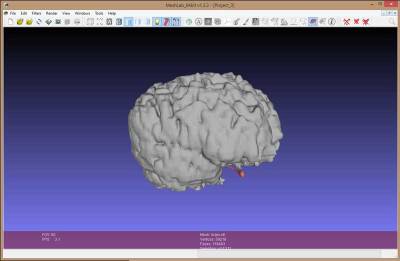 Editing the model in MeshLab. The red bit is a scanning error, about to be deleted.