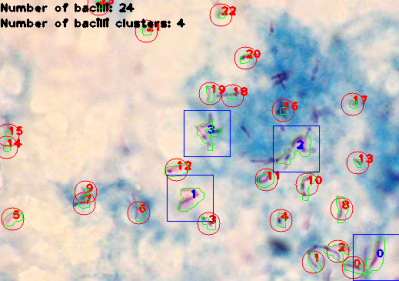 automated_microscope_detection_1