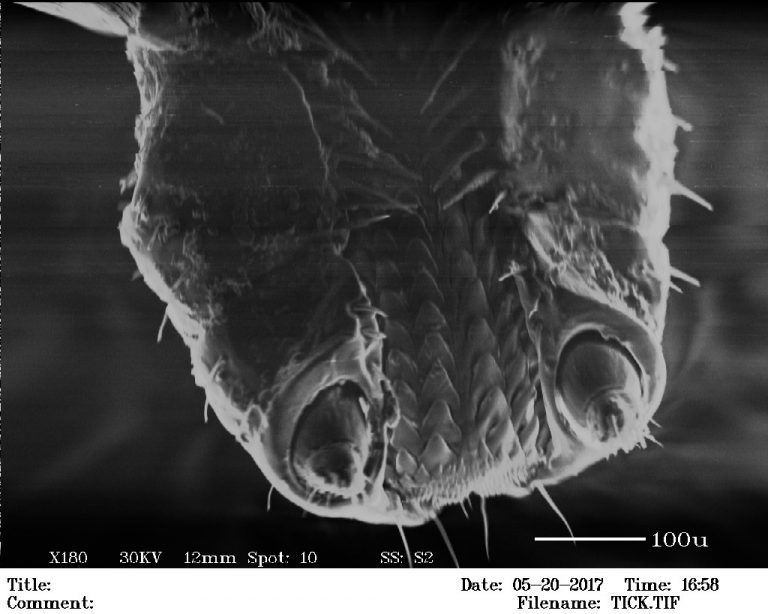 Scanning Electron Microscope Adds To Already Impressive Garage Lab