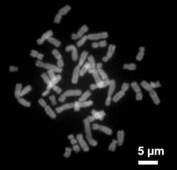 Human chromosomes, long strands of DNA