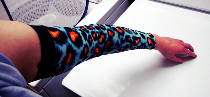 Stretching My Skills: How (and Why) I Made My Own Compression Sleeves
