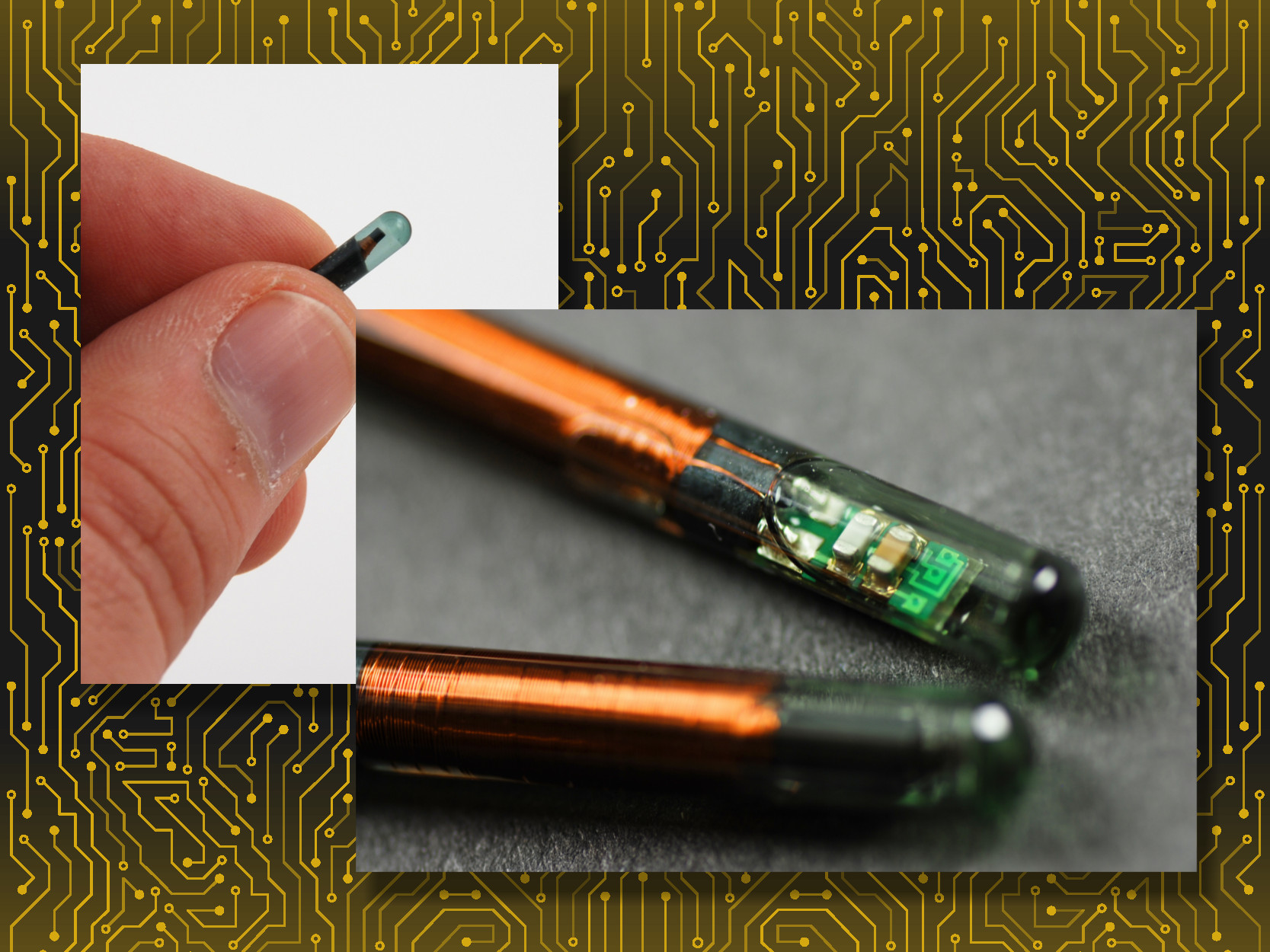 Ask Hackaday What Is The Future Of Implanted Electronics? Hackaday