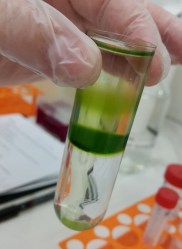 Separated fractions of plant cells in a sugar gradient (for example)