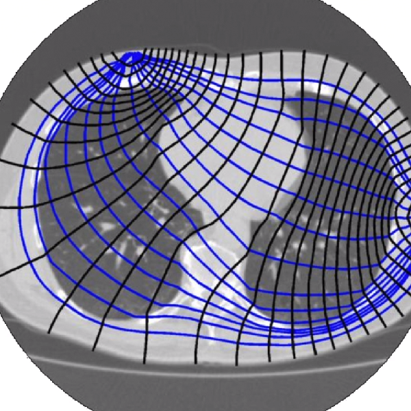Tomography Through An Infinite Grid Of Resistors Hackaday