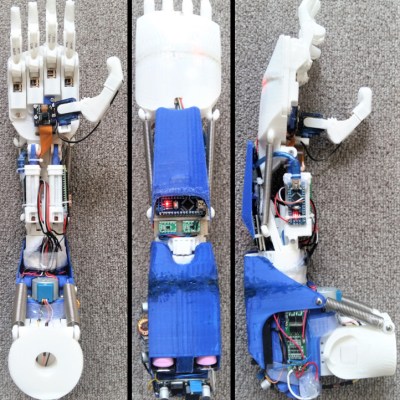 Side views of the 3D printed prosthesis arm.