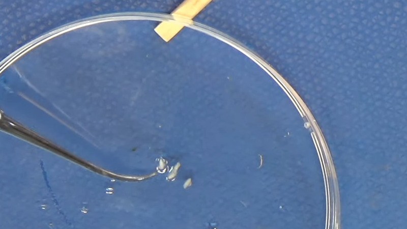 Video: Bil Herds Looks At Mitosis | Hackaday