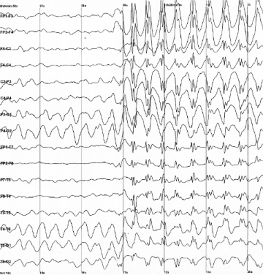 EEG example.