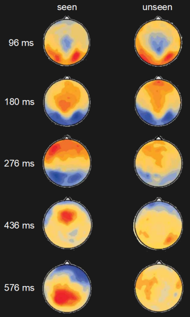 EEG of conscious and unconscious brain activity.