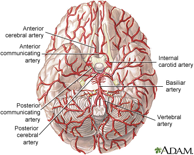Arteries of the brain. (Credit: MedlinePlus, NIH)