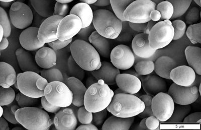 An electron micrograph of yeast cells