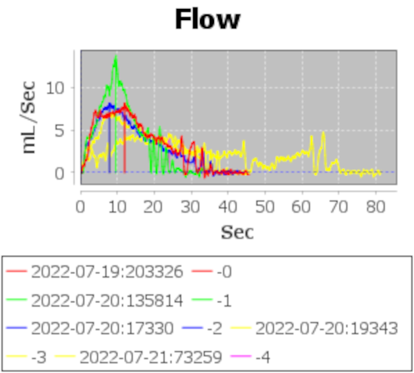 Graph titled "Flow", with X axis saying "seconds" and Y axis saying "ml/Sec". There's differently colored plots on the graph, each apparently corresponding to a different measurement.