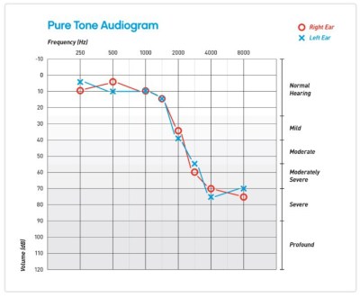 audiogram showing the results of the arduino hearing test device