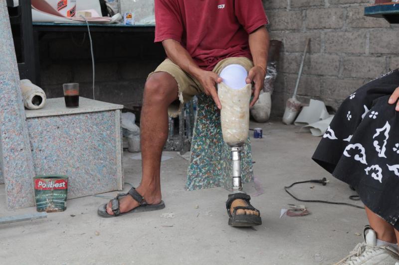 A man with dark skin in a red shirt and khaki shorts sits in a chair. His left leg has a prosthetic below the knee. The upper half of the prosthethic is an off white plastic socket with flecks of different off white plastic throughout hinting at the recycled nature of the plastic. The lower half is a metal tube attached to an artificial foot in black sandals.