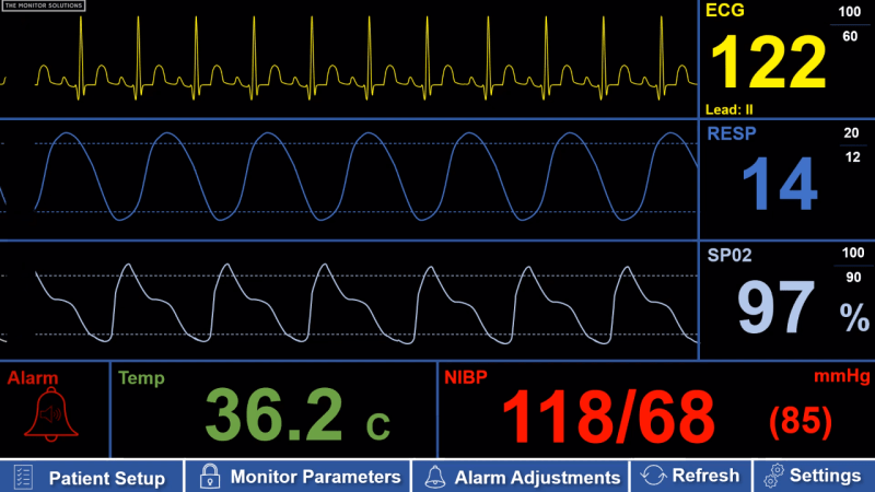 Patient Monitors Screenshot