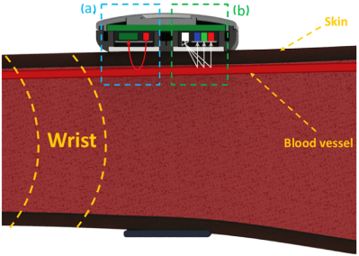 Diagram showing pulse oximeter and color sensor combining to measure oxygen in blood and skin tone