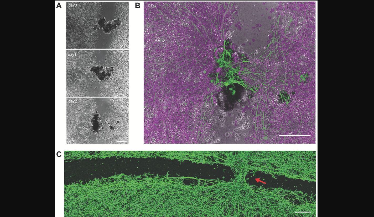 Anthrobots: Tiny Robots From Tracheal Epithelium Cells That Can Fix Neural Damage