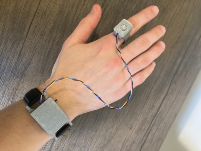 A hand and wrist with a gesture detection ring and a control box on the wrist.