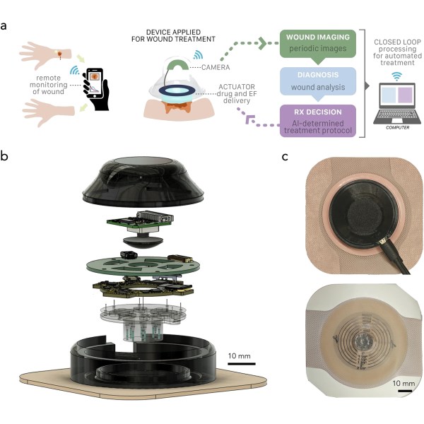 hackaday.com - Lewin Day - Smart Bandage Leverages AI Model For Healing Purposes