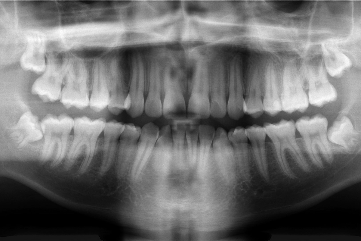 Regrowing Teeth Might Not Be Science Fiction Anymore