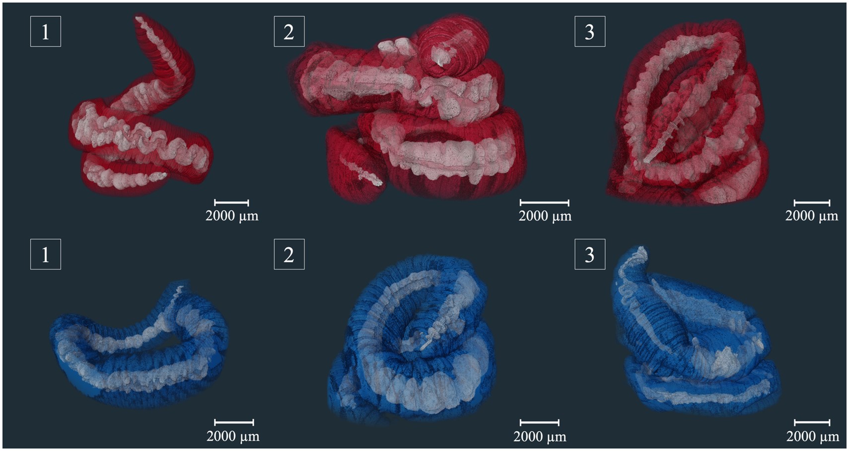 Earthworms’ Unexpected Resistance to Microplastics: Implications for the Food Chain