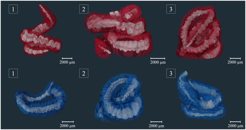 3D reconstruction of x-rayed worms. X-ray absorbing particles in the guts are shown in white.