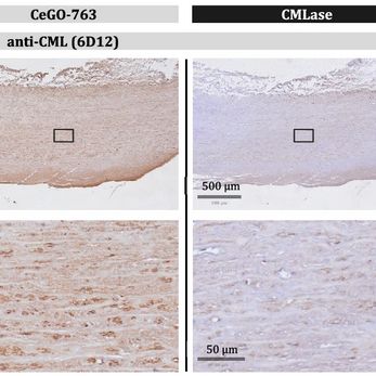 Arterial tissue treated with the CMLase enzyme shows a clear difference. (Credit: Trabosh et al., Nature communications, 2026)