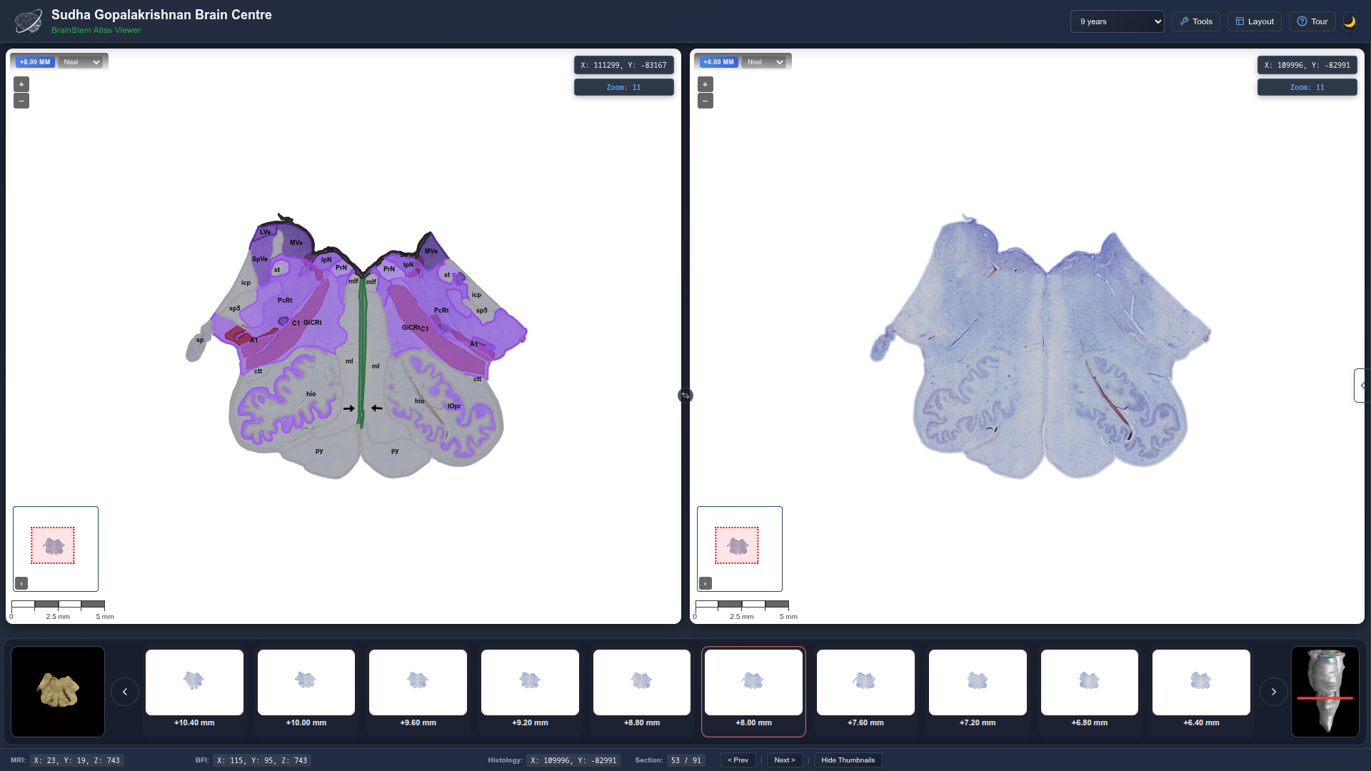 Best-Ever Brainstem Map Created by Indian Scientists